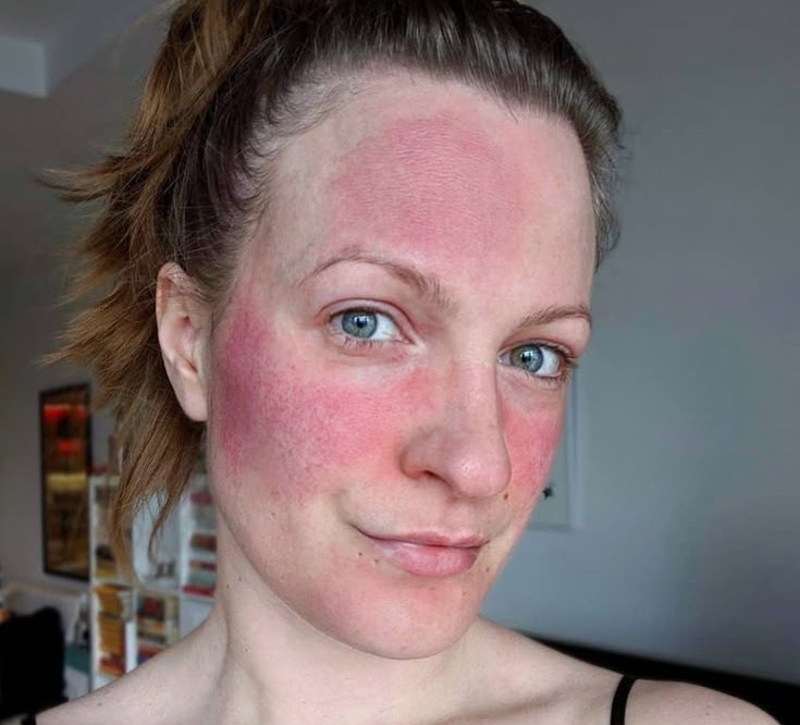 اشتباهات روتین پوستی