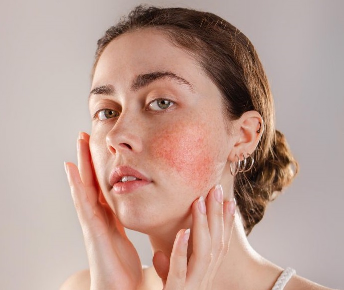 عوارض روتین پوستی